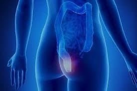 Haemorroids - My Health Oasis