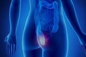 Hemorrhoids - My Health Oasis